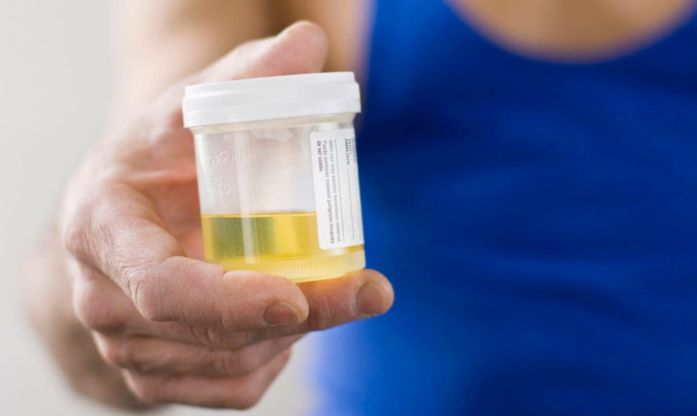 Synthetic Urine Kit Easy To Use Longview Ranchettes Longmont CO